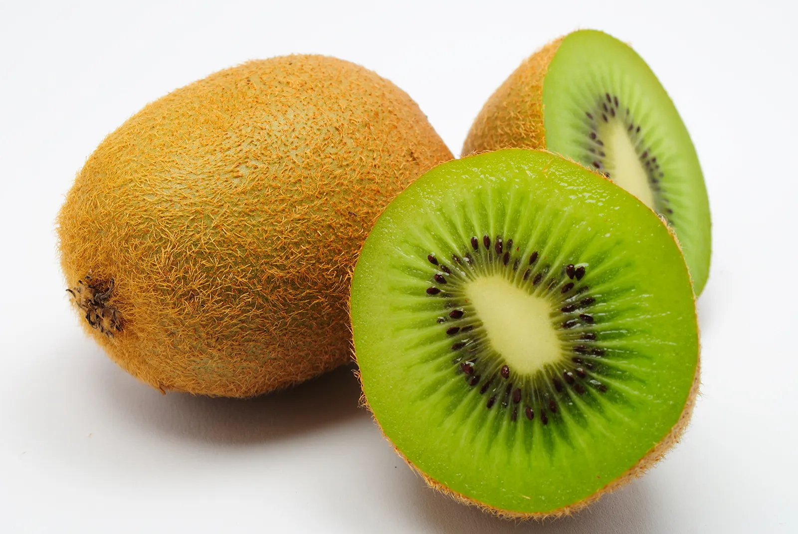 do-kiwis-need-to-be-refrigerated